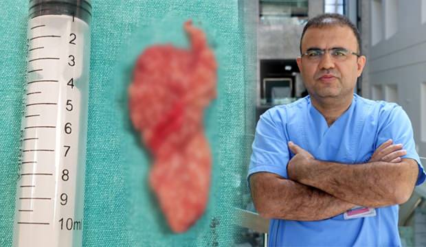 Nefes alamıyorum diyerek gitti! Burnundan 10 santimlik tümör alındı