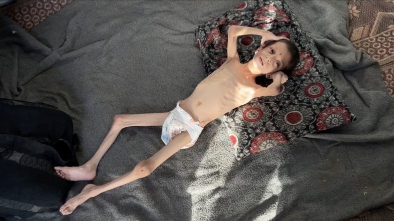 10 yaşındaki Nafız, İsrail'in Gazze'ye uyguladığı kıtlık politikasının kurbanı oldu